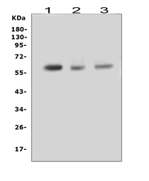 Anti-RUNX2 antibody used in Western Blot (WB). GTX00829