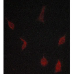 Anti-TGF beta Receptor I antibody used in Immunocytochemistry/ Immunofluorescence (ICC/IF). GTX00840