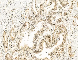 Anti-TGF beta Receptor I antibody used in IHC (Paraffin sections) (IHC-P). GTX00840