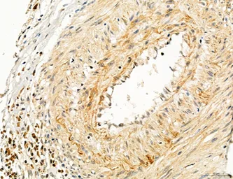 Anti-TGF beta Receptor I antibody used in IHC (Paraffin sections) (IHC-P). GTX00840