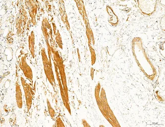 Anti-TGF beta Receptor I antibody used in IHC (Paraffin sections) (IHC-P). GTX00840