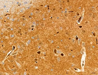 Anti-TGF beta Receptor I antibody used in IHC (Paraffin sections) (IHC-P). GTX00840