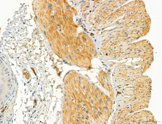 Anti-TGF beta Receptor I antibody used in IHC (Paraffin sections) (IHC-P). GTX00840