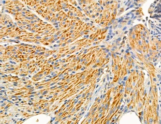 Anti-TGF beta Receptor I antibody used in IHC (Paraffin sections) (IHC-P). GTX00840