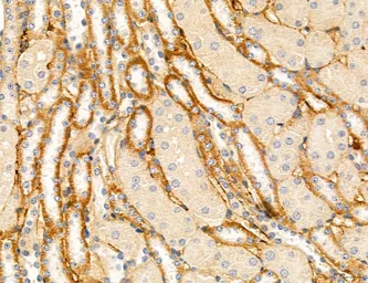Anti-TGF beta Receptor I antibody used in IHC (Paraffin sections) (IHC-P). GTX00840