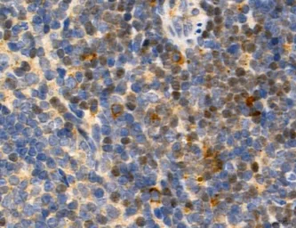 Anti-TGF beta Receptor I antibody used in IHC (Paraffin sections) (IHC-P). GTX00840