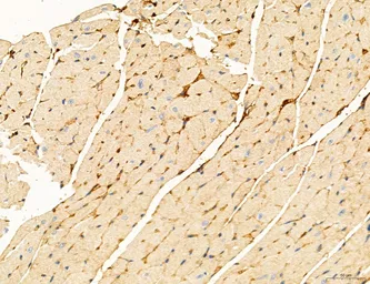 Anti-TGF beta Receptor I antibody used in IHC (Paraffin sections) (IHC-P). GTX00840