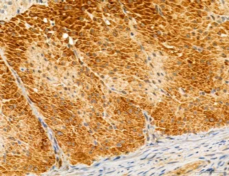 Anti-TGF beta Receptor I antibody used in IHC (Paraffin sections) (IHC-P). GTX00840