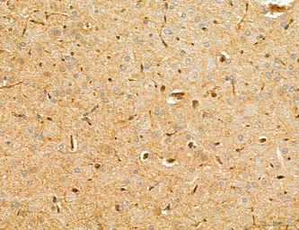 Anti-TGF beta Receptor I antibody used in IHC (Paraffin sections) (IHC-P). GTX00840