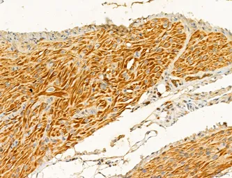 Anti-TGF beta Receptor I antibody used in IHC (Paraffin sections) (IHC-P). GTX00840