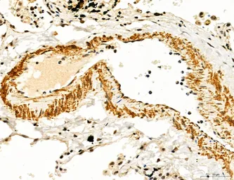 Anti-TGF beta Receptor I antibody used in IHC (Paraffin sections) (IHC-P). GTX00840