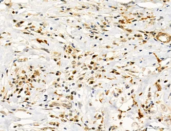 Anti-TGF beta Receptor I antibody used in IHC (Paraffin sections) (IHC-P). GTX00840