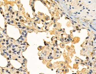 Anti-TGF beta Receptor I antibody used in IHC (Paraffin sections) (IHC-P). GTX00840
