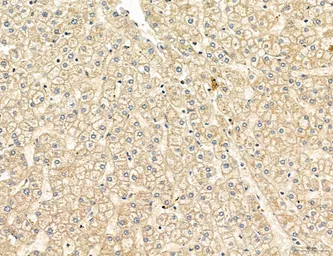 Anti-TGF beta Receptor I antibody used in IHC (Paraffin sections) (IHC-P). GTX00840