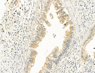 Anti-TGF beta Receptor I antibody used in IHC (Paraffin sections) (IHC-P). GTX00840