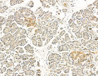 Anti-TGF beta Receptor I antibody used in IHC (Paraffin sections) (IHC-P). GTX00840