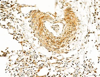 Anti-TGF beta Receptor I antibody used in IHC (Paraffin sections) (IHC-P). GTX00840