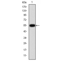 Anti-TGF beta Receptor I antibody used in Western Blot (WB). GTX00840