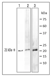 Anti-Vibrio parahaemolyticus TRH Toxin antibody [vp-01] used in Western Blot (WB). GTX00855