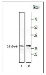 Anti-Bacillus cereus phospholipase C antibody [bc-01] used in Western Blot (WB). GTX00866
