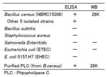 Anti-Bacillus cereus phospholipase C antibody [bc-01] used in  (). GTX00866