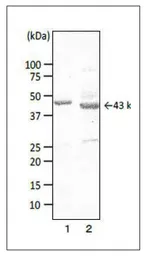 Anti-Campylobacter Porin antibody [cj-01] used in Western Blot (WB). GTX00867