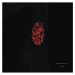 Anti-GAK antibody [9-10] used in Immunocytochemistry/ Immunofluorescence (ICC/IF). GTX00874