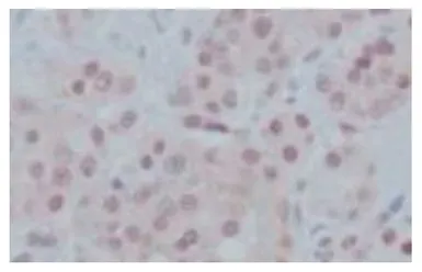 Anti-GAK antibody [9-10] used in IHC (Paraffin sections) (IHC-P). GTX00874