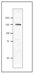 Anti-Pasteurella multocida Dermonecrotic toxin antibody used in Western Blot (WB). GTX00880