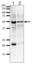 Anti-gamma Tubulin antibody used in Western Blot (WB). GTX00881