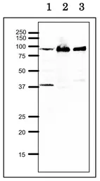 Anti-RRM1 antibody used in Western Blot (WB). GTX00883