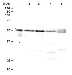 Anti-Rad52 antibody used in Western Blot (WB). GTX00884