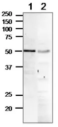 Anti-Rad52 antibody used in Western Blot (WB). GTX00884