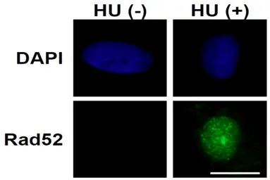 Anti-Rad52 antibody used in Immunocytochemistry/ Immunofluorescence (ICC/IF). GTX00884