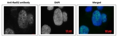 Anti-Rad52 antibody used in Immunocytochemistry/ Immunofluorescence (ICC/IF). GTX00884
