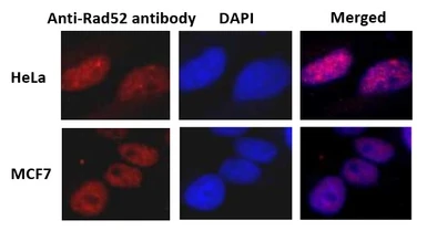 Anti-Rad52 antibody used in Immunocytochemistry/ Immunofluorescence (ICC/IF). GTX00884
