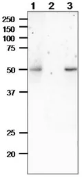 Anti-Rad52 antibody used in Immunoprecipitation (IP). GTX00884