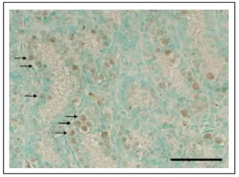 Anti-RAD18 antibody used in IHC (Paraffin sections) (IHC-P). GTX00887