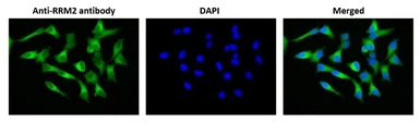 Anti-RRM2 antibody used in Immunocytochemistry/ Immunofluorescence (ICC/IF). GTX00888