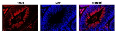 Anti-RRM2 antibody used in IHC (Paraffin sections) (IHC-P). GTX00888