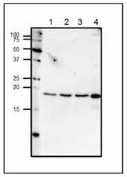 Anti-Centrin 1 antibody used in Western Blot (WB). GTX00891