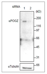Anti-Pogz antibody used in Western Blot (WB). GTX00892