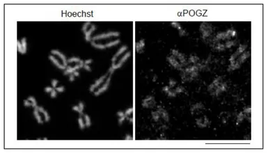 Anti-Pogz antibody used in Immunocytochemistry/ Immunofluorescence (ICC/IF). GTX00892
