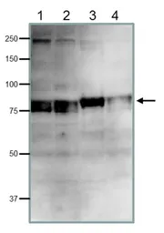 Anti-CDT2 antibody used in Western Blot (WB). GTX00893
