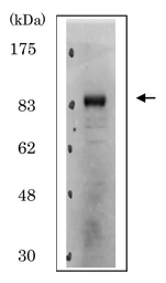 Anti-CDT2 antibody used in Western Blot (WB). GTX00893