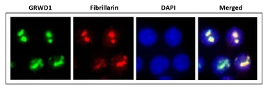 Anti-GRWD1 antibody used in Immunocytochemistry/ Immunofluorescence (ICC/IF). GTX00895