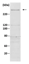 Anti-TAF1 antibody used in Western Blot (WB). GTX00900