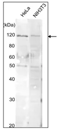 Anti-alanyl-tRNA synthetase antibody used in Western Blot (WB). GTX00903