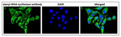 Anti-alanyl-tRNA synthetase antibody used in Immunocytochemistry/ Immunofluorescence (ICC/IF). GTX00903