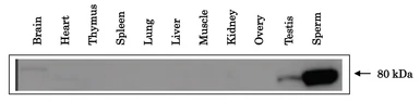 Anti-ACE3 antibody used in Western Blot (WB). GTX00904